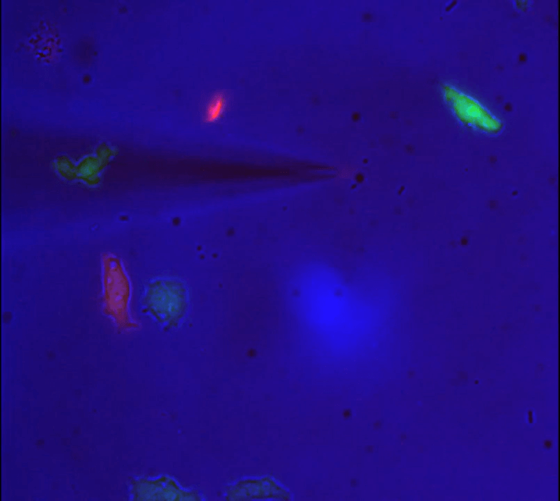Needle containing PDGF shown attracting stem cells